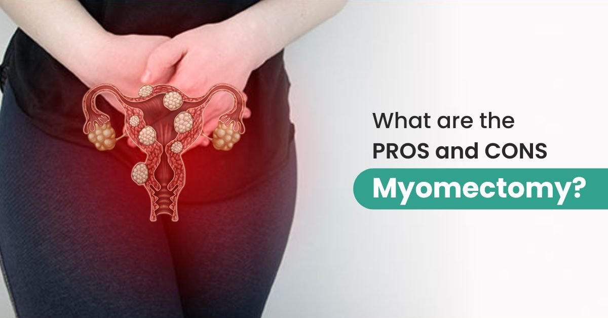 What are the PROS and CONS of Myomectomy?